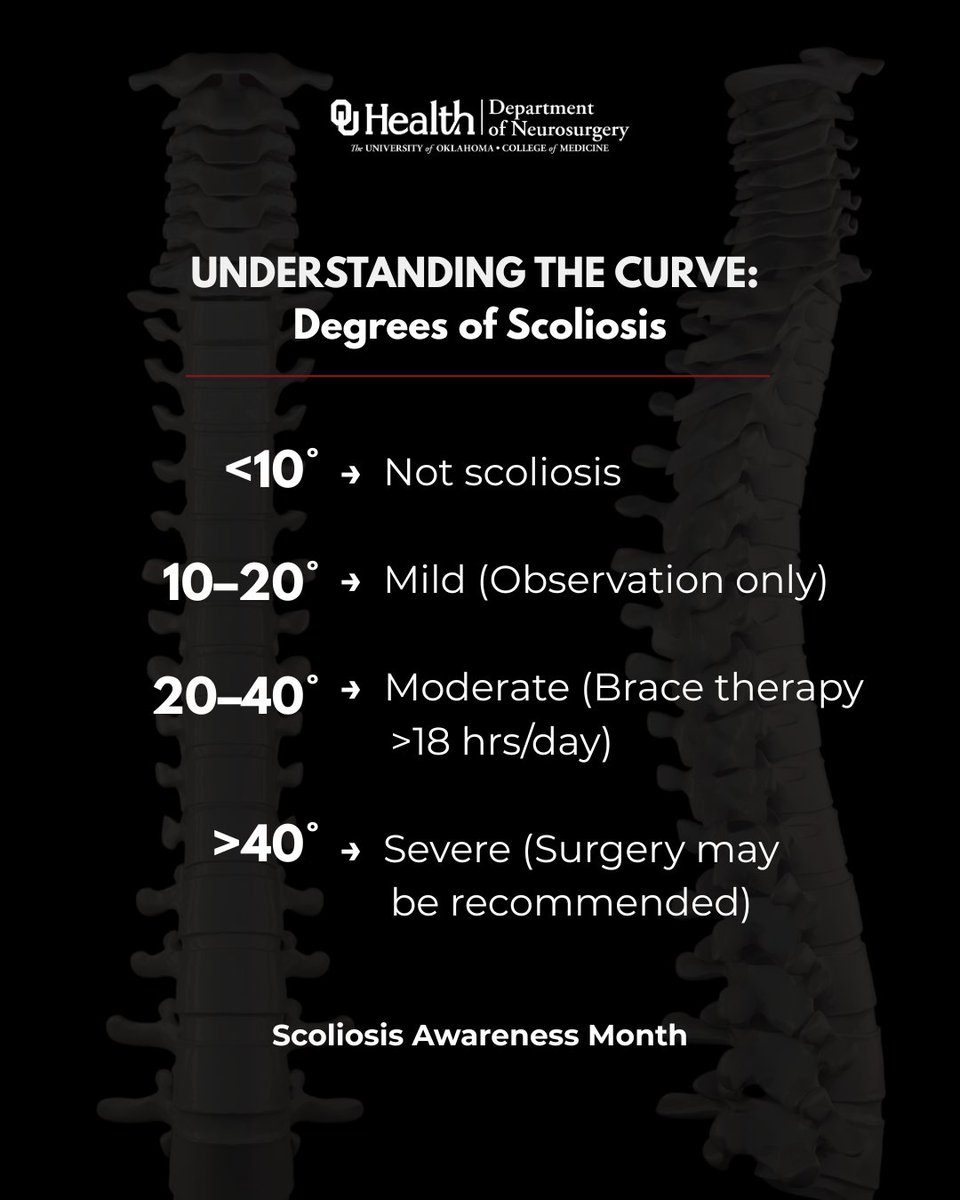 OU_Neurosurgery's tweet image. Scoliosis isn’t just a curve—it’s a condition that evolves with growth.
For kids, treatments like magnetic rods or vertebral body tethering can guide the spine early on. Spinal fusion is often used once growth stops. #ScoliosisAwarenessMonth