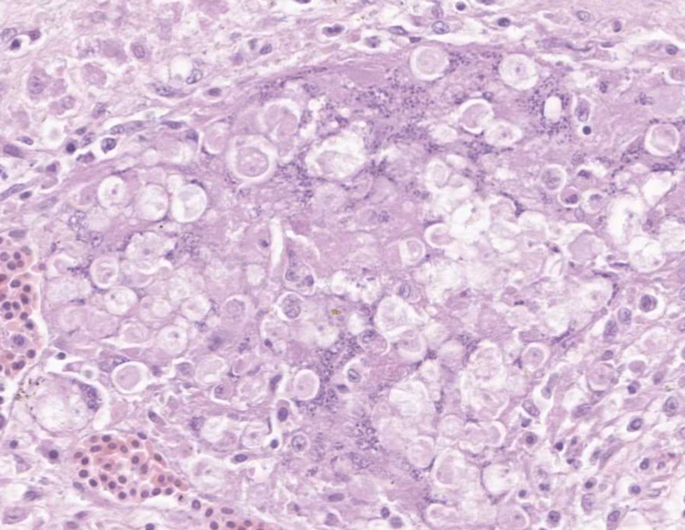 VetPathophile's tweet photo. Ok, Team #VetPath, it's Monday, let's go!
What's the deal with these autopsy findings in a turkey?
❓Histopath features
❓Cause https://t.co/ByEhAUX2Uy
