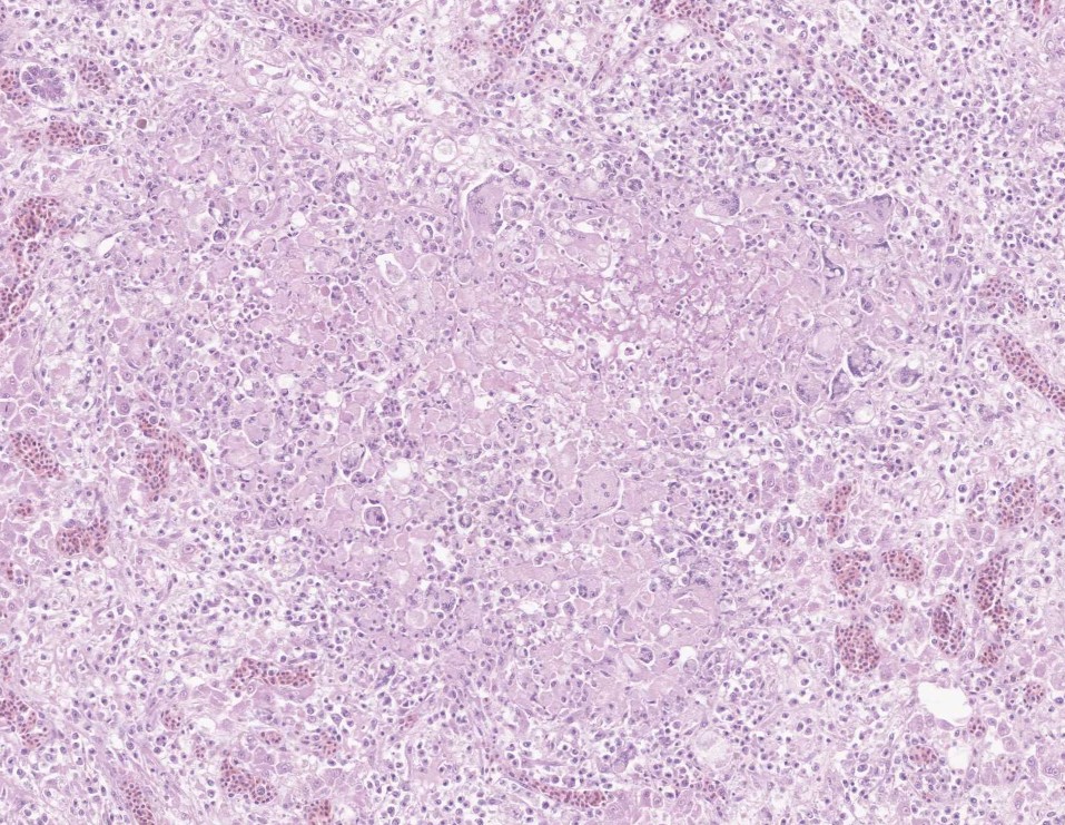 VetPathophile's tweet photo. Ok, Team #VetPath, it's Monday, let's go!
What's the deal with these autopsy findings in a turkey?
❓Histopath features
❓Cause https://t.co/ByEhAUX2Uy