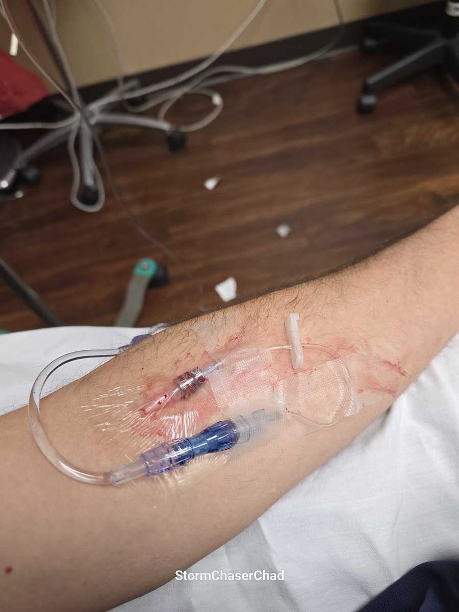 StormChaserChad's tweet image. **BLOOD WARNING**
Please use extra caution when working outside in this heat! Just cause you've been through it before doesn't mean it can't catch up to you! I'll smack my head twice as hard before thinking differently! #wxtwitter #heatwave #Itshotasballz