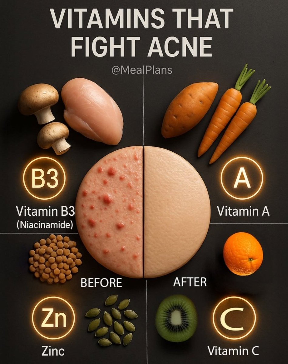 food_health_joy's tweet photo. Vitamins That Fight Acne✨️🌱 https://t.co/fqulvlYv8G