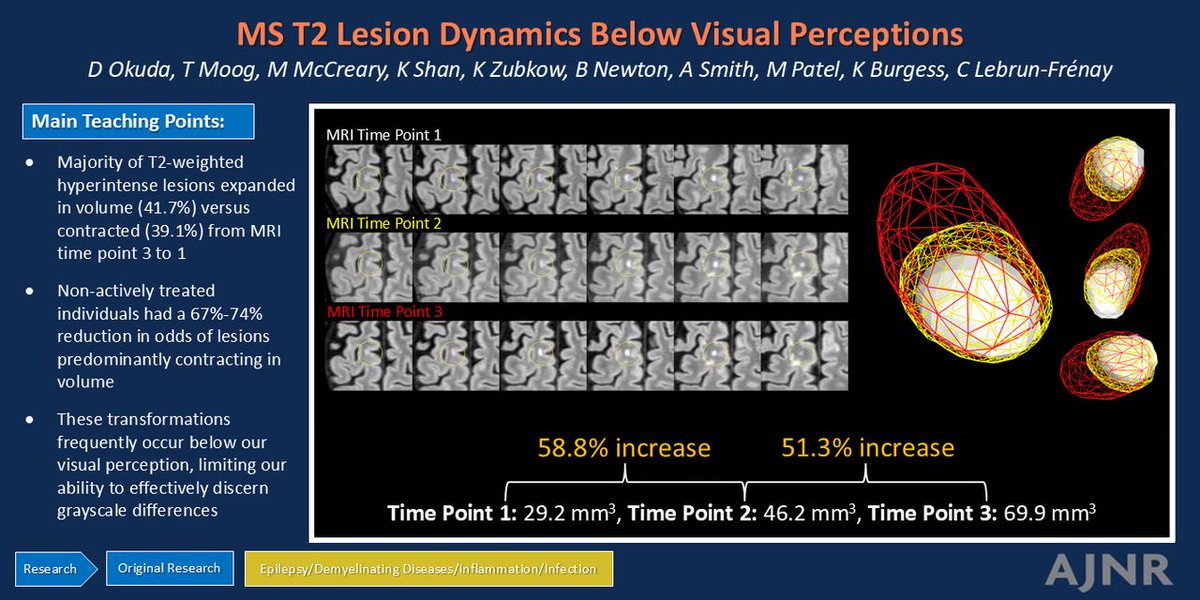 UTSWNeurology's tweet image. Darin Okuda M.D., and his collaborators published “Dynamic Expansion and Contraction of Multiple Sclerosis T2-Weighted Hyperintense Lesions Are Present below the Threshold of Visual Perception” in @TheAJNR: bit.ly/43MYY1w 

Okuda Lab: bit.ly/4e8kiC5

#brain