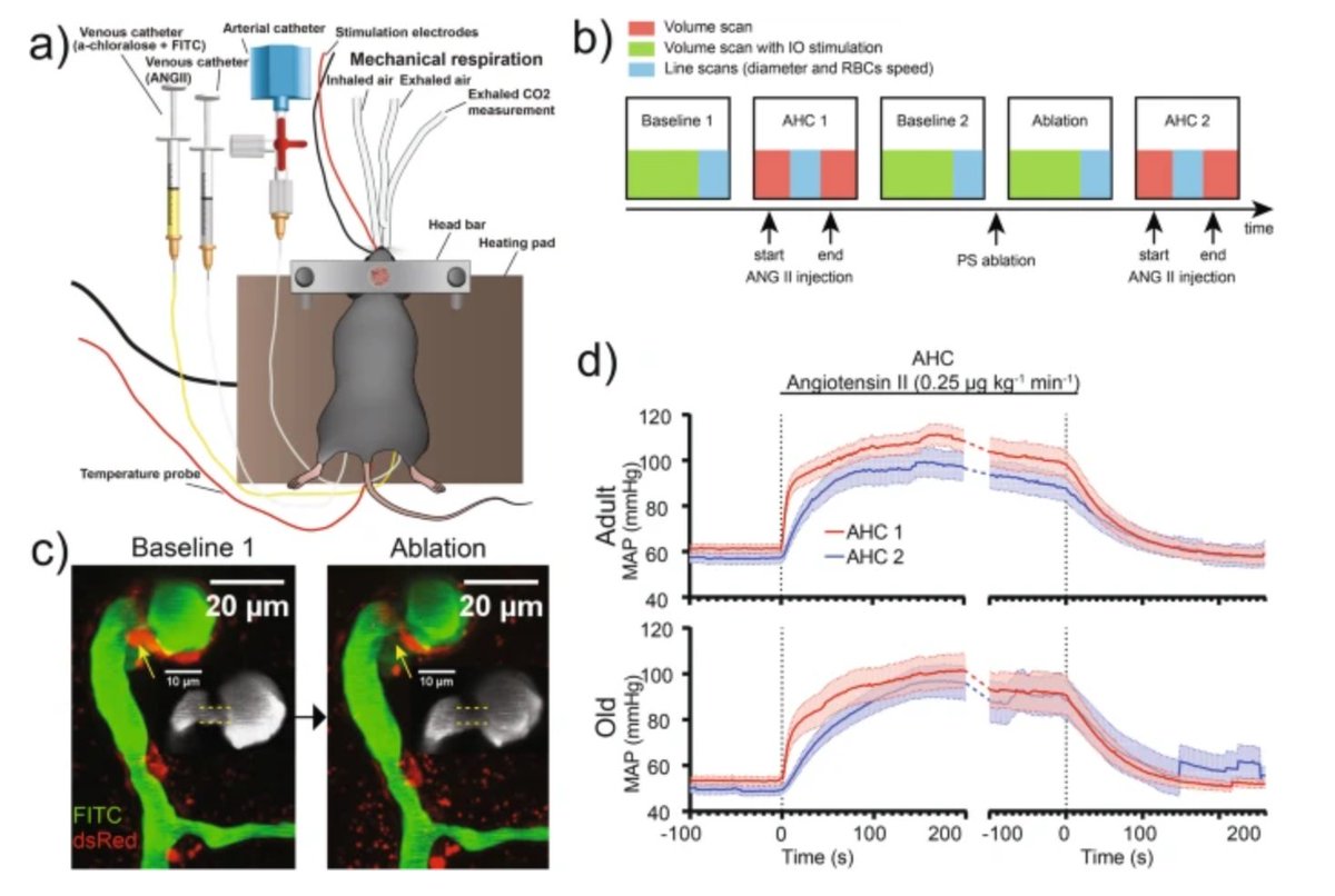 GeroScienceAGE's tweet photo. 📢Breaking: New Open🔓 Access Publication
Brain precapillary sphincters modulate myogenic tone in adult and aged mice by Christina L. Fjorbak & Søren Grubb (@SorenGrubb) et al.
https://t.co/NUVhoKwrn3
#aging #pericyte #Hypertension #precapillarysphincter #autoregulation #myogenicresponse