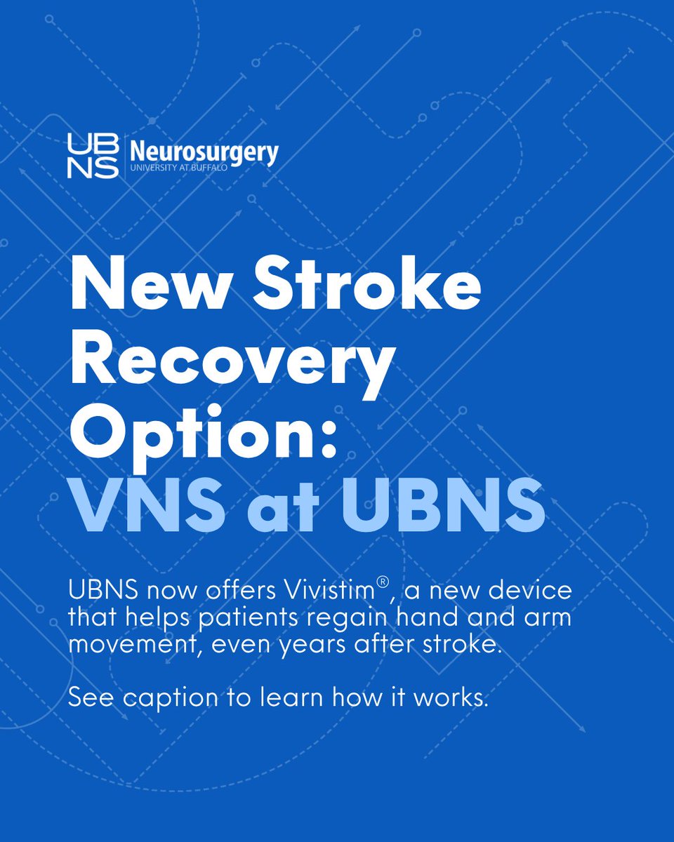 Thanks to <a href="/PublisherBHL/">BuffaloHealthyLiving</a> for highlighting a major advance in #stroke care: <a href="/vivistimsystem/">Vivistim</a> VNS, now available at #UBNS.

“We’re committed to bringing novel neurotech, such as Vivistim, to our patients + community.” — @eladlevymd buffalohealthyliving.com/new-stroke-rec…