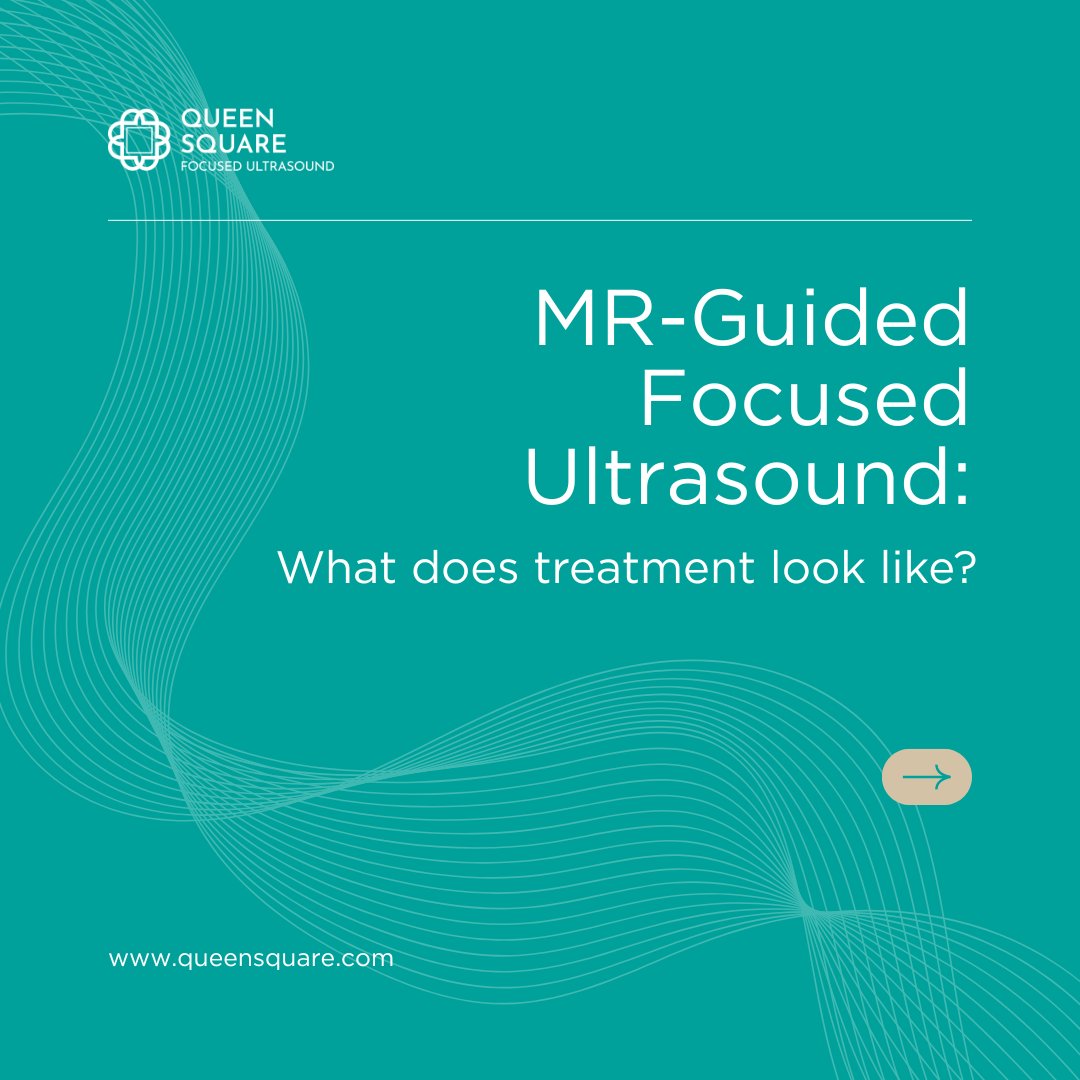 QueenSquareFUS's tweet image. MR-Guided Focused Ultrasound is a non-invasive treatment option used to treat tremor in people living with Essential Tremor or Tremor-Dominant Parkinson’s disease.
#MRGuidedFocusedUltrasound #EssentialTremor #ParkinsonsTremor #LivingWithTremor #TremorTreatment