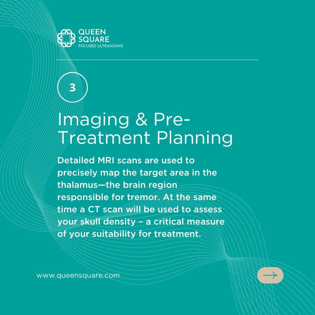 QueenSquareFUS's tweet image. MR-Guided Focused Ultrasound is a non-invasive treatment option used to treat tremor in people living with Essential Tremor or Tremor-Dominant Parkinson’s disease.
#MRGuidedFocusedUltrasound #EssentialTremor #ParkinsonsTremor #LivingWithTremor #TremorTreatment