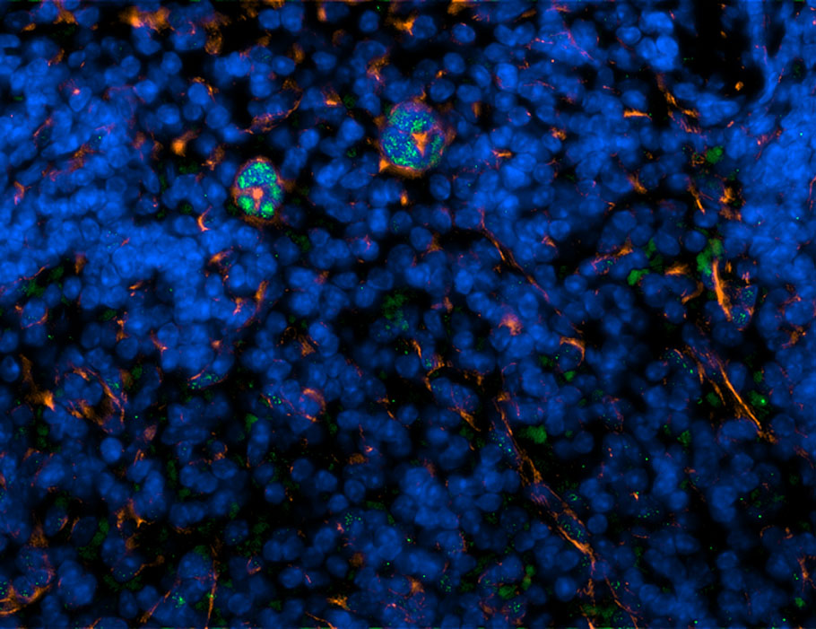 Science Immunology (@sciimmunology) on Twitter photo Scientists have found that tumor necrosis factor can switch macrophage #efferocytosis from immunologically silent to pro-inflammatory during #sepsis and systemic inflammation. <a href="/LabPoltorak/">Poltorak Lab</a>
Learn more in Science #Immunology: scim.ag/45Yvj6Y Scientists have found that tumor necrosis factor can switch macrophage #efferocytosis from immunologically silent to pro-inflammatory during #sepsis and systemic inflammation. <a href="/LabPoltorak/">Poltorak Lab</a>
Learn more in Science #Immunology: scim.ag/45Yvj6Y