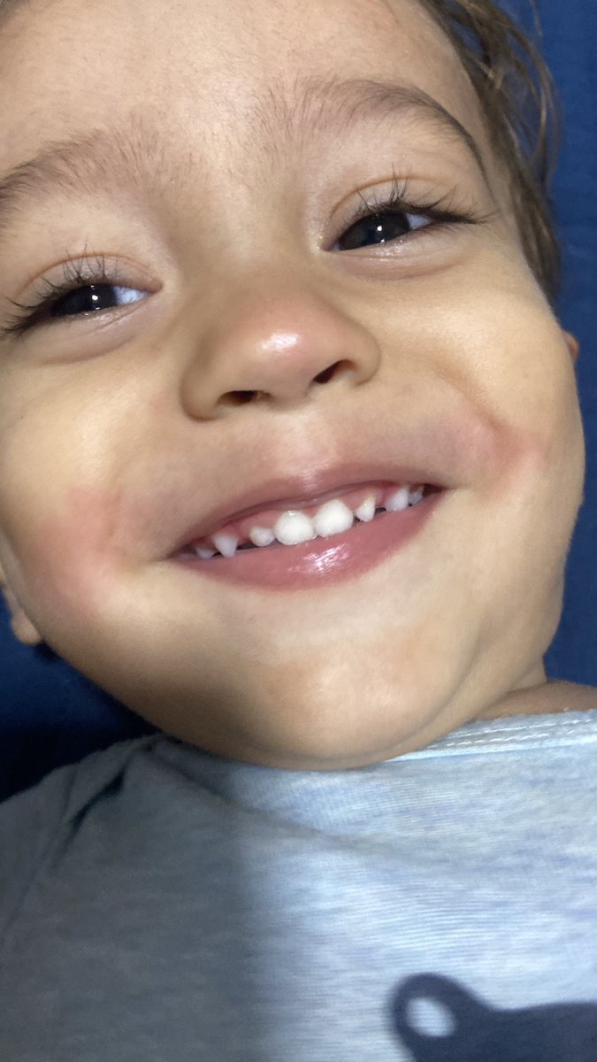 gianlpaes's tweet photo. @YUTAG4DO Pior que quando nasce é o bebê mais lindo do mundo para os pais, pqp. Hoje vejo fotos do meu filho recém nascido e não entendo como achava bonito kkkkkkkkk
Antes/agora https://t.co/17s0DZo7Ix
