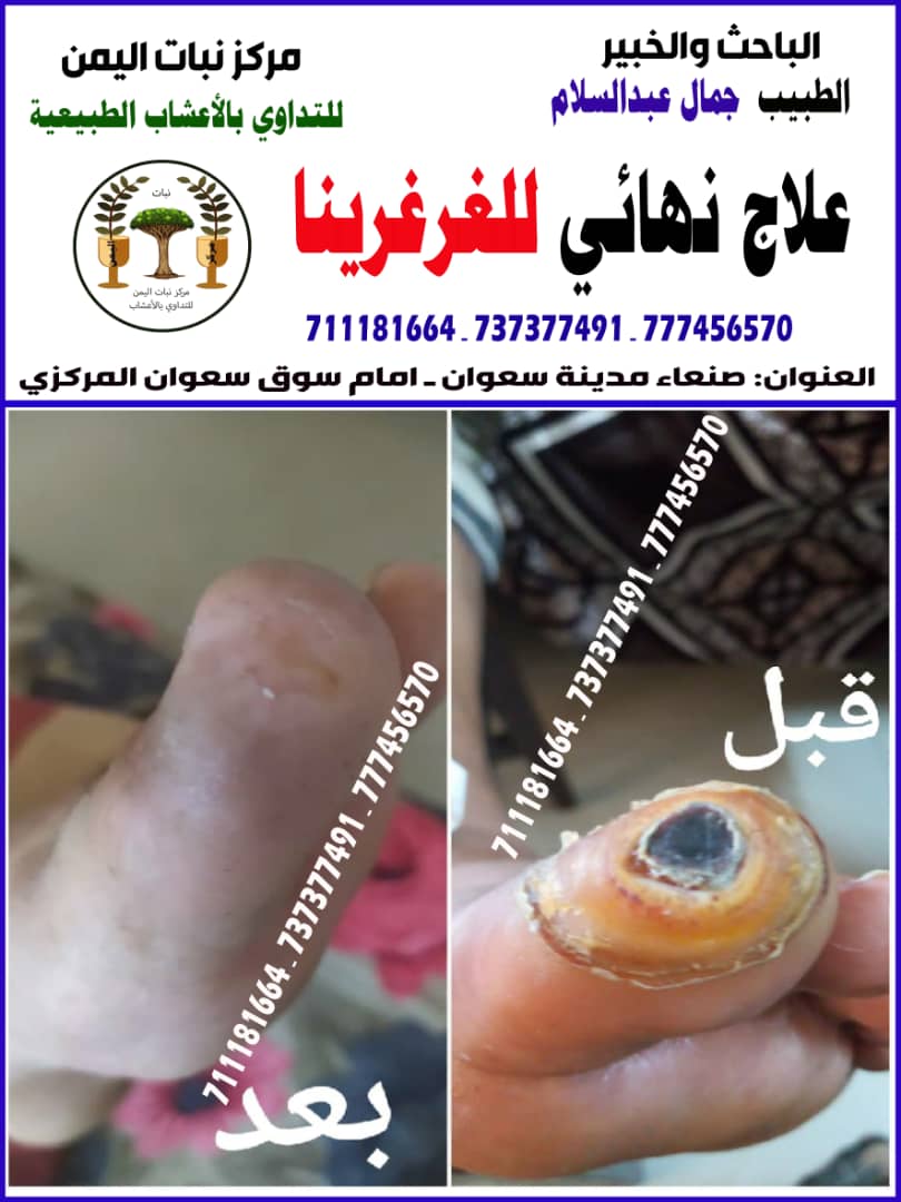 د/جمال عبد السلام الظمين (@dalslam46376) on Twitter photo 