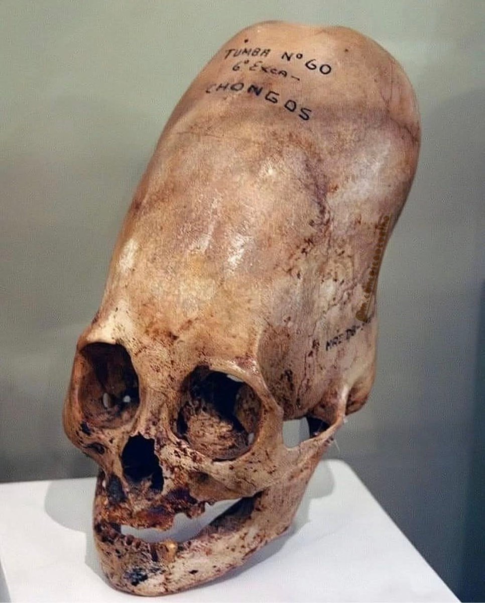 My very 1st post on Instagram in 2011: Ica Regional Museum. The largest Paracas skull found to date. It was found in the village of Chongos, near the city of Pisco, Ica. According to studies, it has a cranial capacity 25% greater than a normal skull, weighs 60% more, has larger