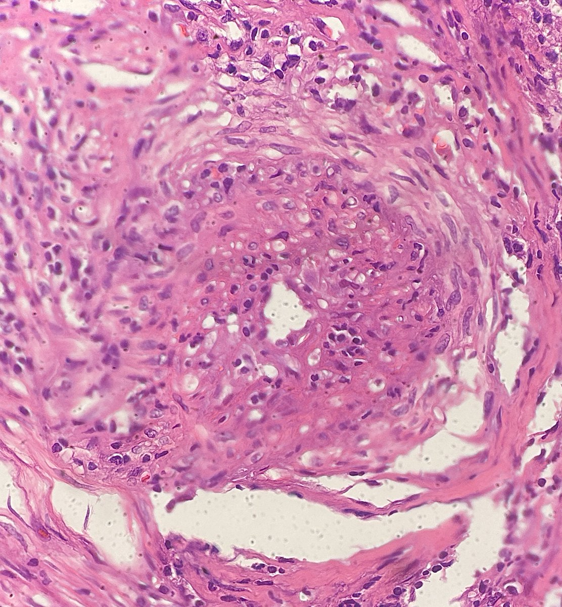 Jay "Thymocyte" Hwang tweet media