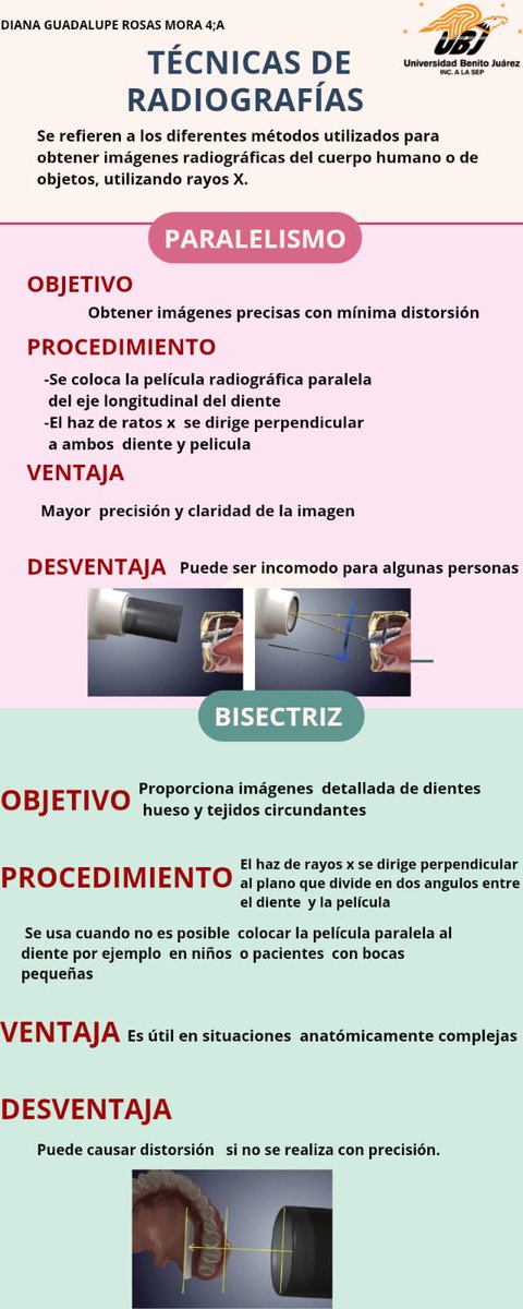 DIANAGU27771774's tweet photo. Técnicas para toma de radiografía.
En estomatología
#Radiografia
#UBJ https://t.co/wEgbAKFSY6