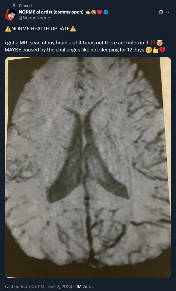 Cone (@lol8ball) on Twitter photo 