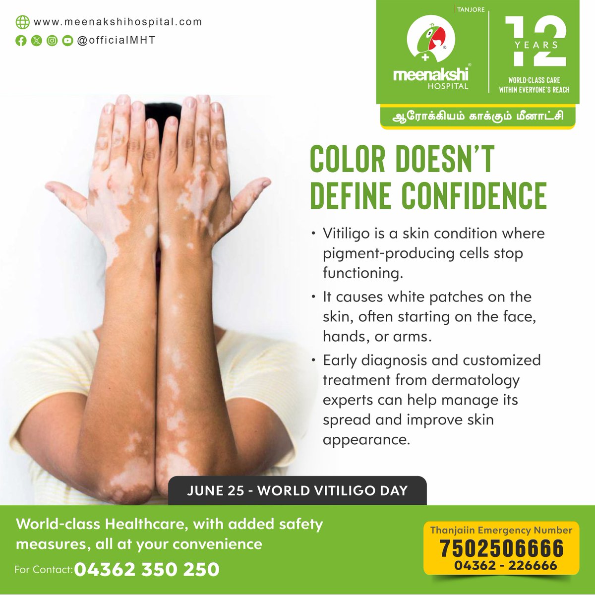 Color Doesn’t Define Confidence! Early diagnosis and customized treatment from Dermatology experts can help manage its spread and improve skin appearance.

#WorldVitiligoDay #VitiligoDay2025 #DermatologyMatters #meenakshihospital #meenakshihospitalthanjavur #MHT #Thanjavur
