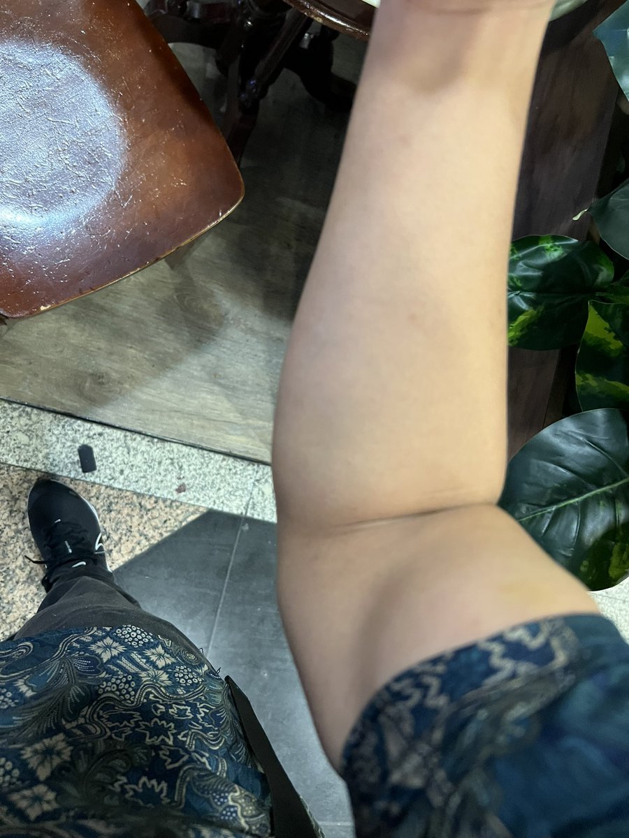 My mom : ketat nya baju 🤨