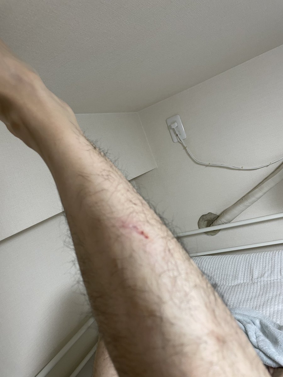 BESPER_arariku's tweet image. 今日サッカーした夢見たんですよ。
良いクロスが上がって来て空中ボレーをしようと思ったら現実の俺も思いっきり蹴りをかましたらしく、写真にある角にスネを強打して飛び起きました。
『痛ぇえええええ！！！！！』って声出しながら。
おかげでスネがえぐれました。