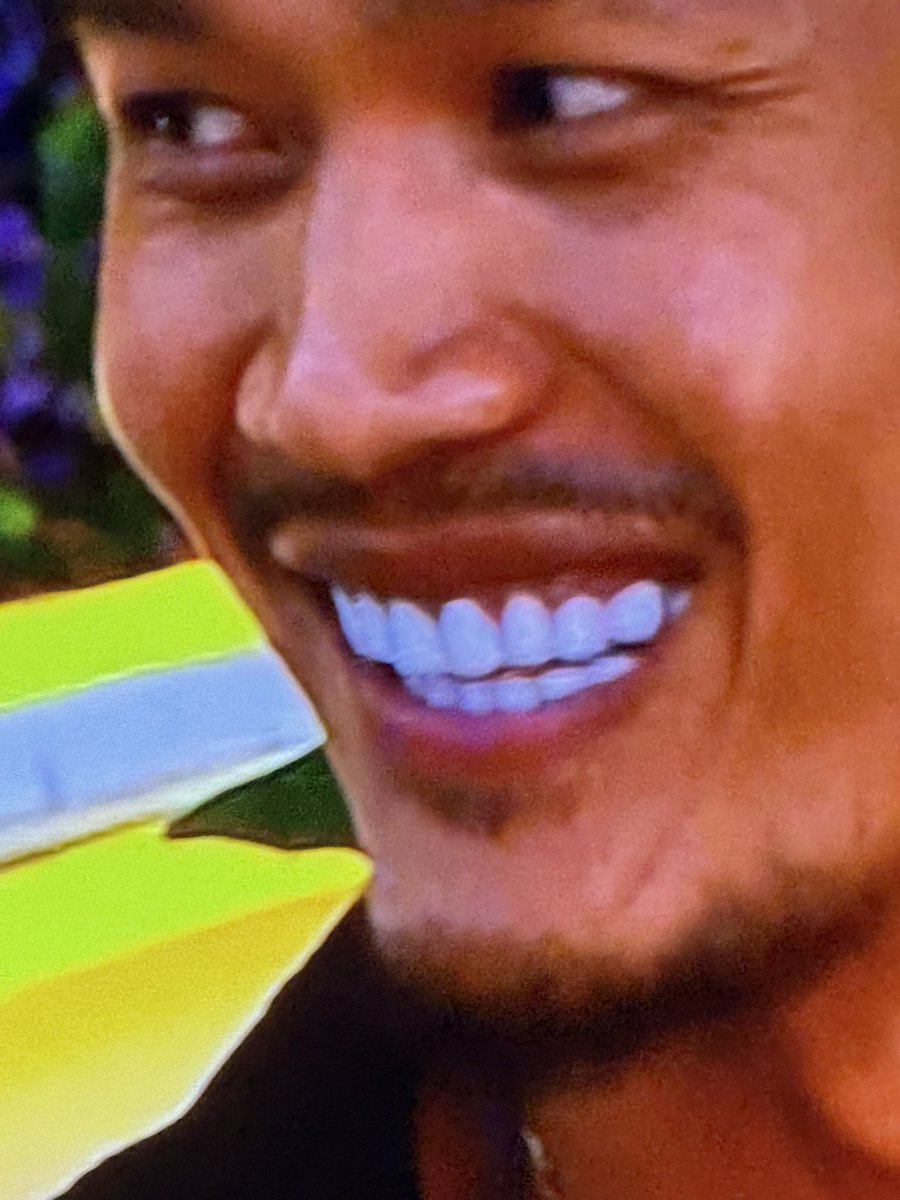 cherry_busx's tweet photo. Craziest veneers I’ve ever seen. Olandria do NOT tickle those ivory’s. Look like Brian eeuuhghhh I’m sick. #LoveIslandUSA https://t.co/JHVCbIUGg9