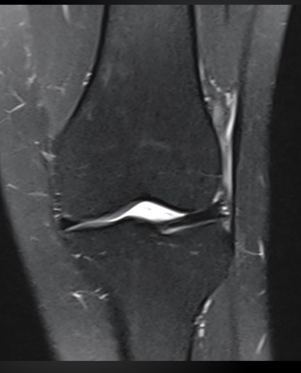 JM ZuluetaOdriozola tweet media