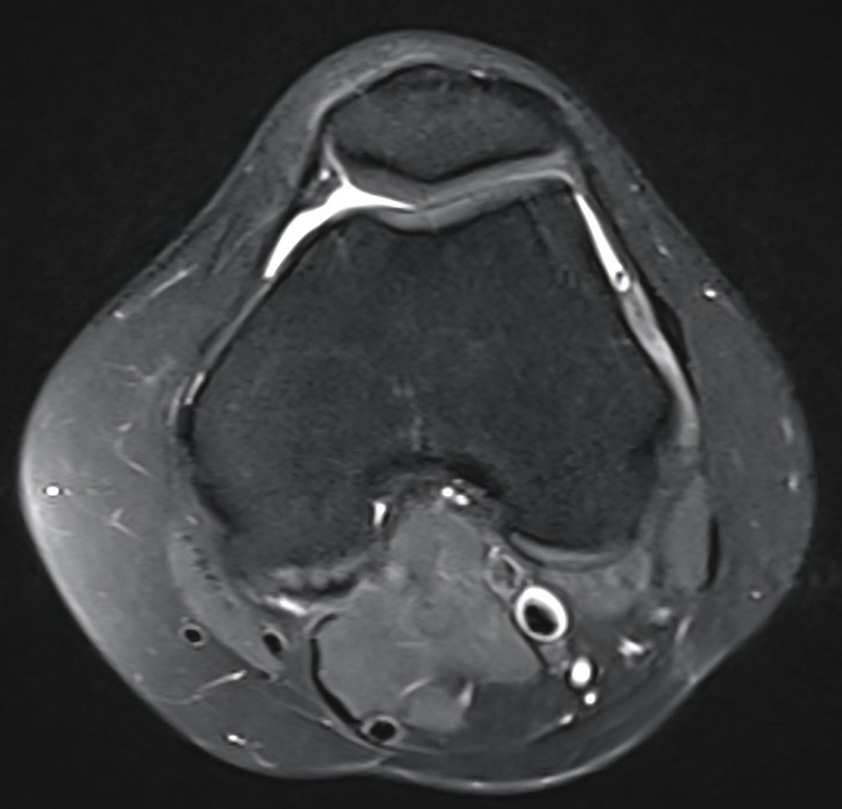 JM ZuluetaOdriozola tweet media