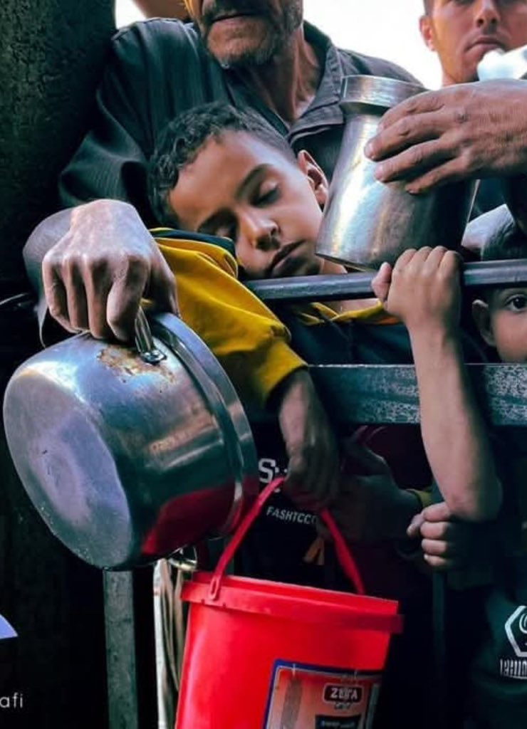 Zionists kill kids and starve others, Zionism is a cancer