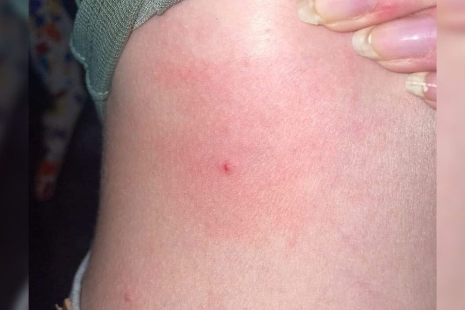 Incognito_qfs's tweet photo. 145 people (mostly white french girls) were pricked with needles in France during a nationwide music festival over the weekend. 

Twelve people were arrested in connection with the attacks.

France is turning into a third world country fast. 

If something like this had happened in India, whole western media would have declared India the most unsafe country in the world for women. But, they won't speak a word about 'women safety' in France now. No lectures.
