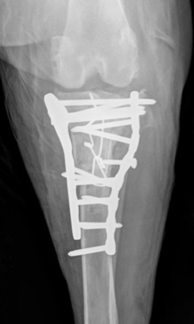 Final week of early bird rates for 'Revision Surgery' - our autumn meeting in Bristol. More details and booking info here bvoa.co.uk/events/bvoa-au…