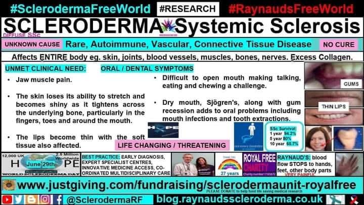 cosmicfairy444's tweet image. June #SclerodermaAwarenessMonth
ORAL / DENTAL Infographic
blog.raynaudsscleroderma.co.uk/2018/11/the-sc… 
#SclerodermaFreeWorld #RaynaudsFreeWorld #Research #Scleroderma #SystemicSclerosis #Raynauds #Autoimmune #RareDisease #NoCure #UnknownCause #LifeChanging #ConnectiveTissue