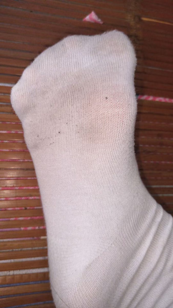 酸酸臭臭小白袜有没有贱狗想要史诗级过肺的。#白袜 #贱狗 #调教 #sm #原味 #玉足 #脚底奴