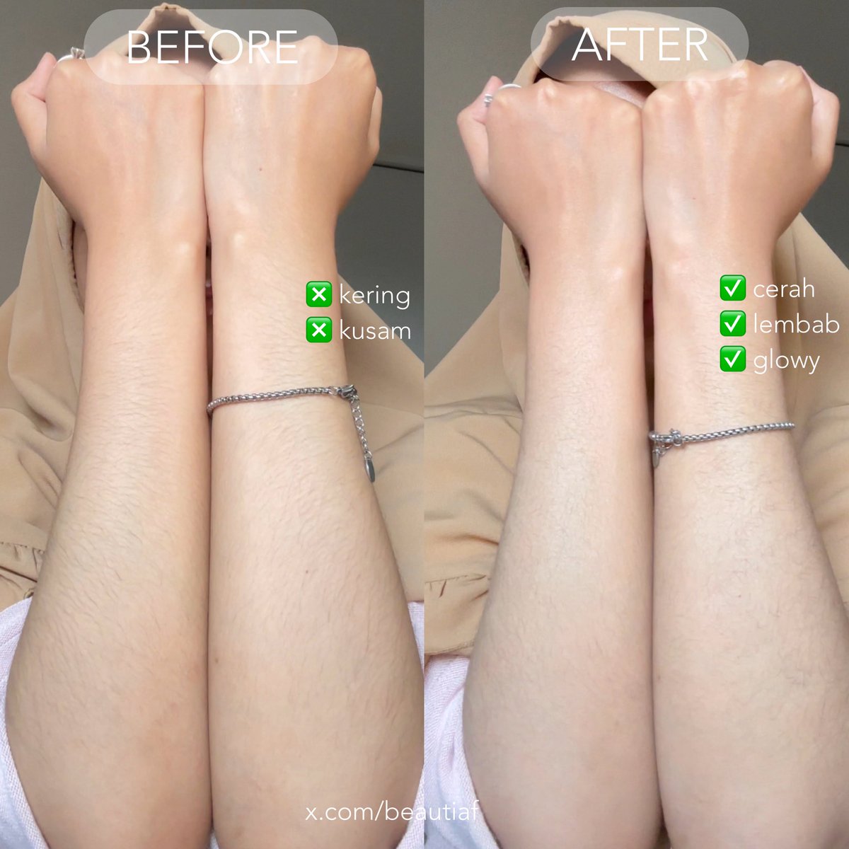 caraku bikin kulit cerah &amp; merata: RUTIN PAKE BODY LOTION MINIMAL 2X SETIAP HARI💯

beli body lotion yang ISINYA BANYAK dan ingredientsnya gak cm melembabkan tp mencerahkan juga, biar kulit glowing kaya gini⤵️