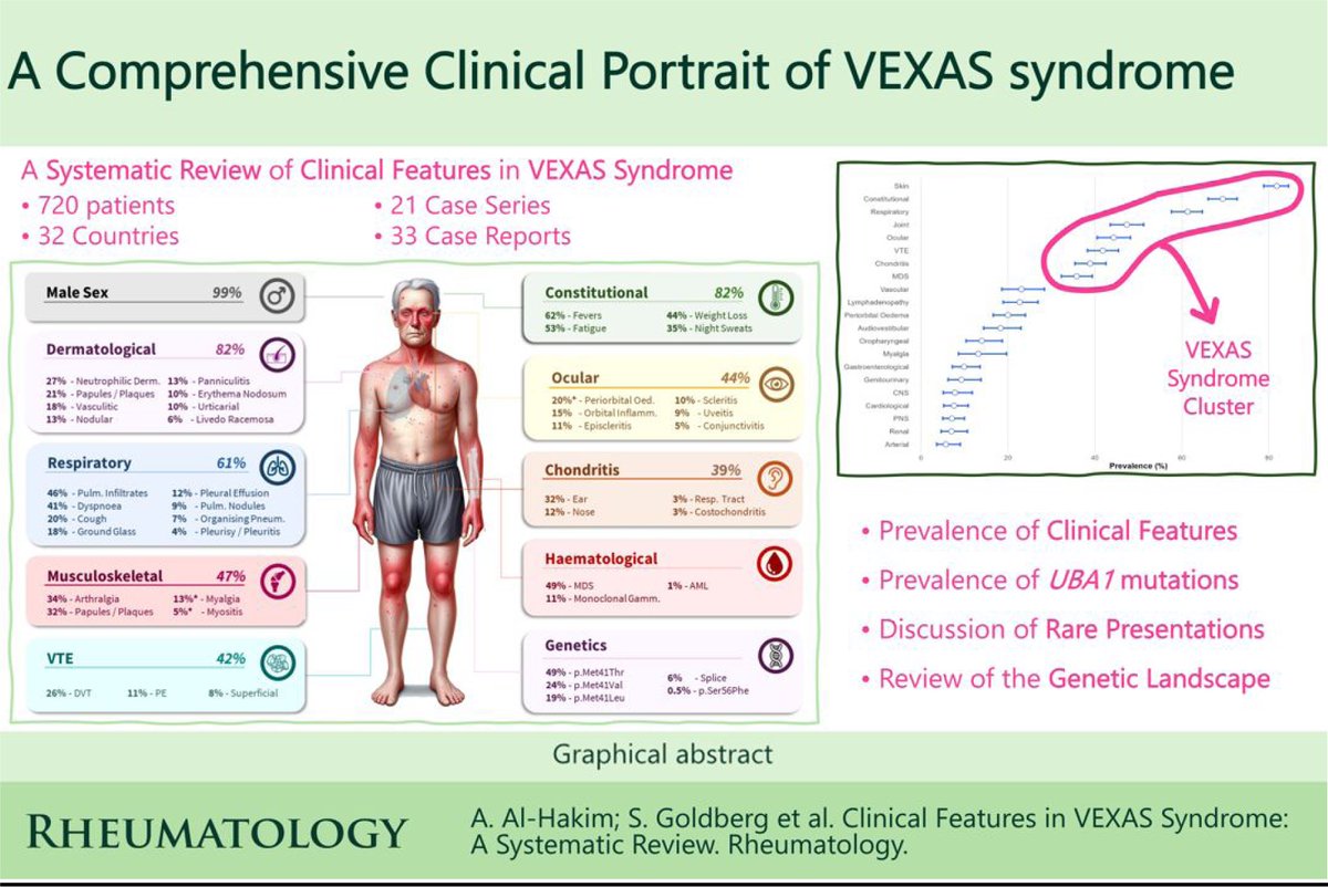 Rheumatology & Rheumatology Advances in Practice (@rheumjnl) on Twitter photo New systematic review by <a href="/sinisauksav/">Siniša Savić</a> et al. characterises the complete phenotypic spectrum of VEXAS syndrome.
➡️These findings will facilitate earlier diagnosis, inform monitoring strategies, and guide future research priorities.
➡️bit.ly/40gp76A New systematic review by <a href="/sinisauksav/">Siniša Savić</a> et al. characterises the complete phenotypic spectrum of VEXAS syndrome.
➡️These findings will facilitate earlier diagnosis, inform monitoring strategies, and guide future research priorities.
➡️bit.ly/40gp76A