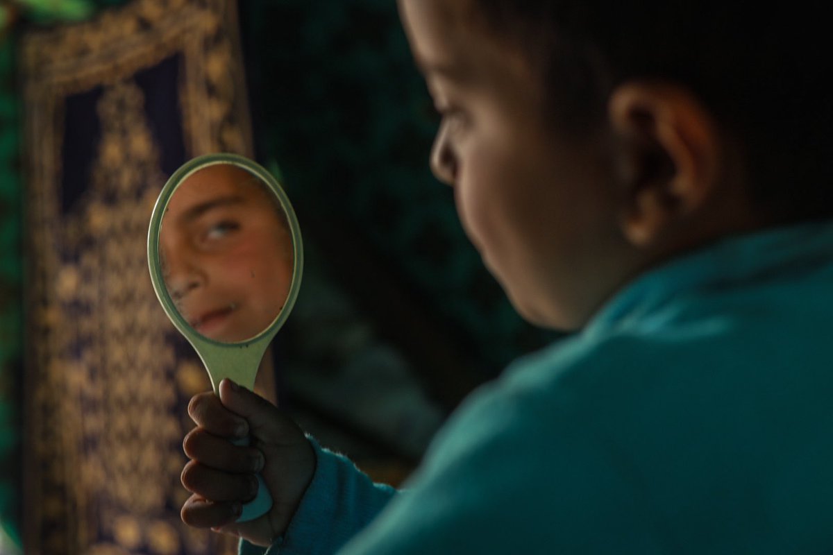 HaninMahir96's tweet photo. In Gaza’s war, I met Imran, 5, who lost his father and eye to a missile while playing.
He dreams of becoming an eye doctor to restore sight.
These photos tell of stolen innocence and unbroken hope.
 
By: Haneen Salem https://t.co/wkSUvD0Sxv