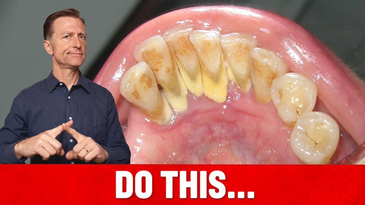 Tartar is hardened plaque that can cause bad breath, gum problems, and tooth damage.

Try this simple baking soda rinse and add vitamin K2 and herbs like clove and garlic.

This easy fix could change your dental health

Watch the full video to see how.

drbrg.co/45xAESy
