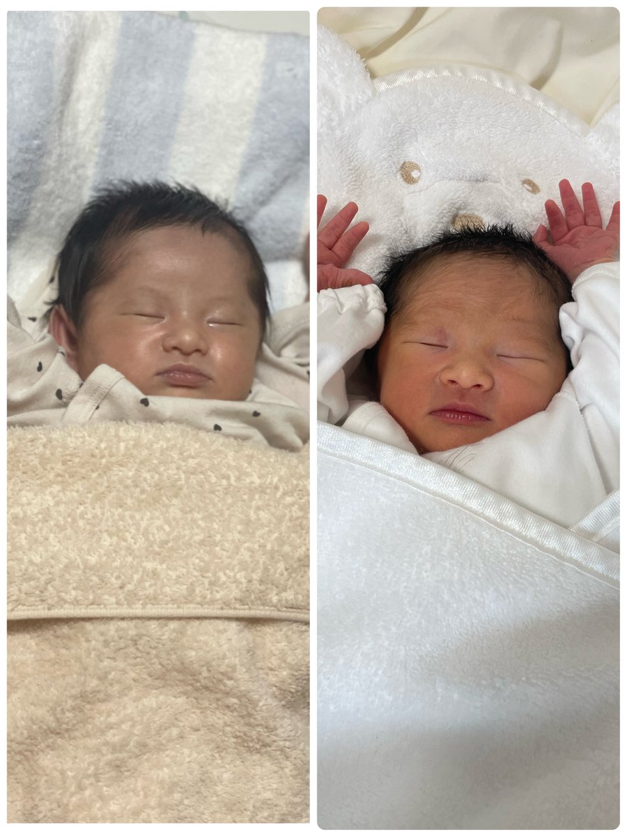 satochan3700's tweet photo. 生後2日と現在👶🏻
おでこの産毛が抜けて顔がデカくなった🥹
成長するのほんと早いなぁ🥺 https://t.co/aYgVaOmcj5