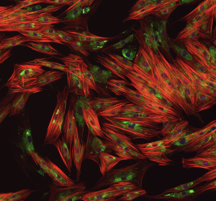cgeorgiaw's tweet image. 🧬 super psyched to announce a new collaboration between @huggingface and @Ginkgo to open up high-quality biological datasets for the machine learning community!
Just dropped the GDPx and GDPa dataset series on the Hub (x1000 boost to AI for drug development)…