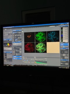 afrodita_dn's tweet photo. ...Concretely, at day 7, 8 and 9 after fertilisation. Epiblast, hypoblast and trophoblast cells have been evaluated in these blastocysts by immunofluorescence using SOX2, SOX17 and GATA3 antibodies, respectively."
#MSCA #DoctoralNetworks #HorizonEurope #bovinereproduction #embryo https://t.co/w9UjKLhP27