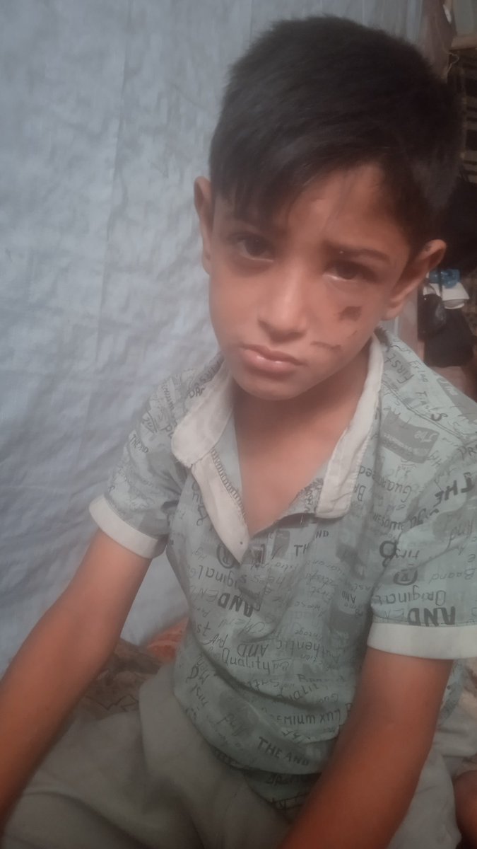 rv20g__'s tweet image. Please please help me please. This is my little baby💔💔
social.fund/hbnocf/?sw=2
