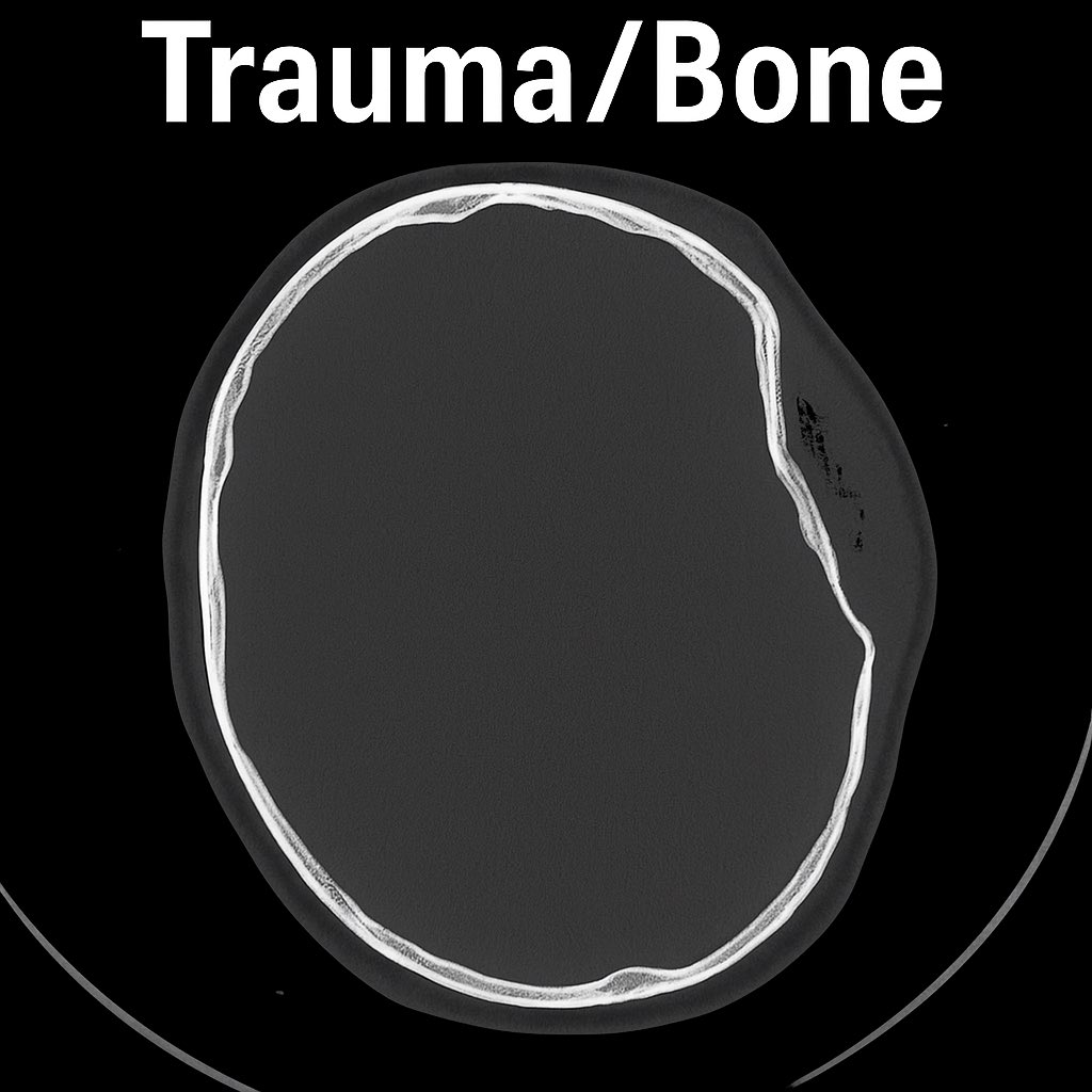 SarMrb's tweet photo. 🧠 Reading a non-contrast head CT?
Don’t miss the big stuff - think MIST:

M – Midline shift
I – Intracranial hemorrhage
S – Sulci &amp; cisterns
T – Trauma/bone window

One scan. Four steps. Every time.

#NeuroRad #EMrad #Radiology #RadiologyResident https://t.co/StXztPtaDK