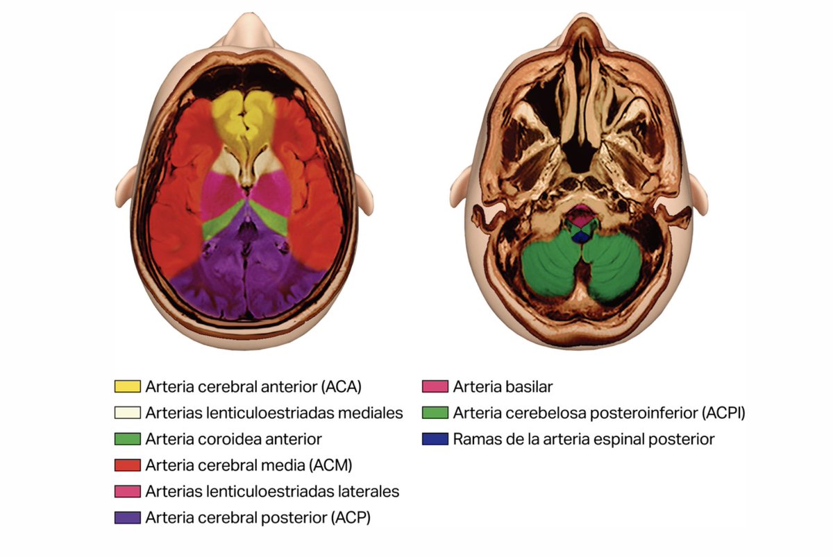 FcoAyusoMC's tweet image. #EVC isquémico. 
Arteria y territorio cerebral de irrigación. 
#strokerecovery