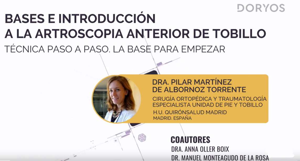 institutoIOTAM's tweet photo. La #artroscopia de #tobillo es clave para:
🟣 Diagnosticar patologías de tobillo 🦶.
🟣 Tratar lesiones articulares 🩺.
La Dra. Pilar Martínez de Albornoz de #IOTAM nos explica en el siguiente vídeo esta técnica, sus complicaciones y evolución 💹.
https://t.co/tueLffIUnD https://t.co/7LC10Y9S07