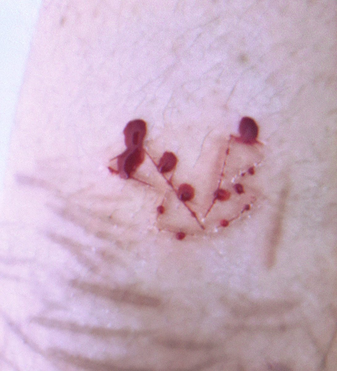 small sessions from before i js felt like posting
what can i say i luv bvb <3
ik its barely much but im censoring anyways :3 (if i didnt do it right someone tell me)