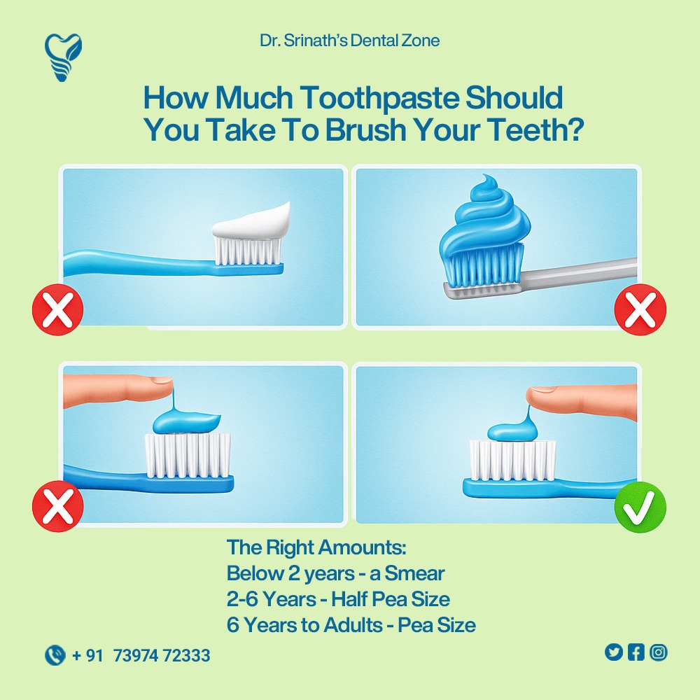 SrinathDental's tweet image. Are You Using Too Much Toothpaste?#ToothpasteTips #DentalCare #OralHealth #ToothpasteAmount #PediatricDentist #DentalAwareness #HealthySmile #KidsDentalCare #DentistIndia #ToothCare #FluorideFacts #ProperBrushing #SmileBright #DrSrinathsDentalZone #IndianDentist #ToothbrushTips