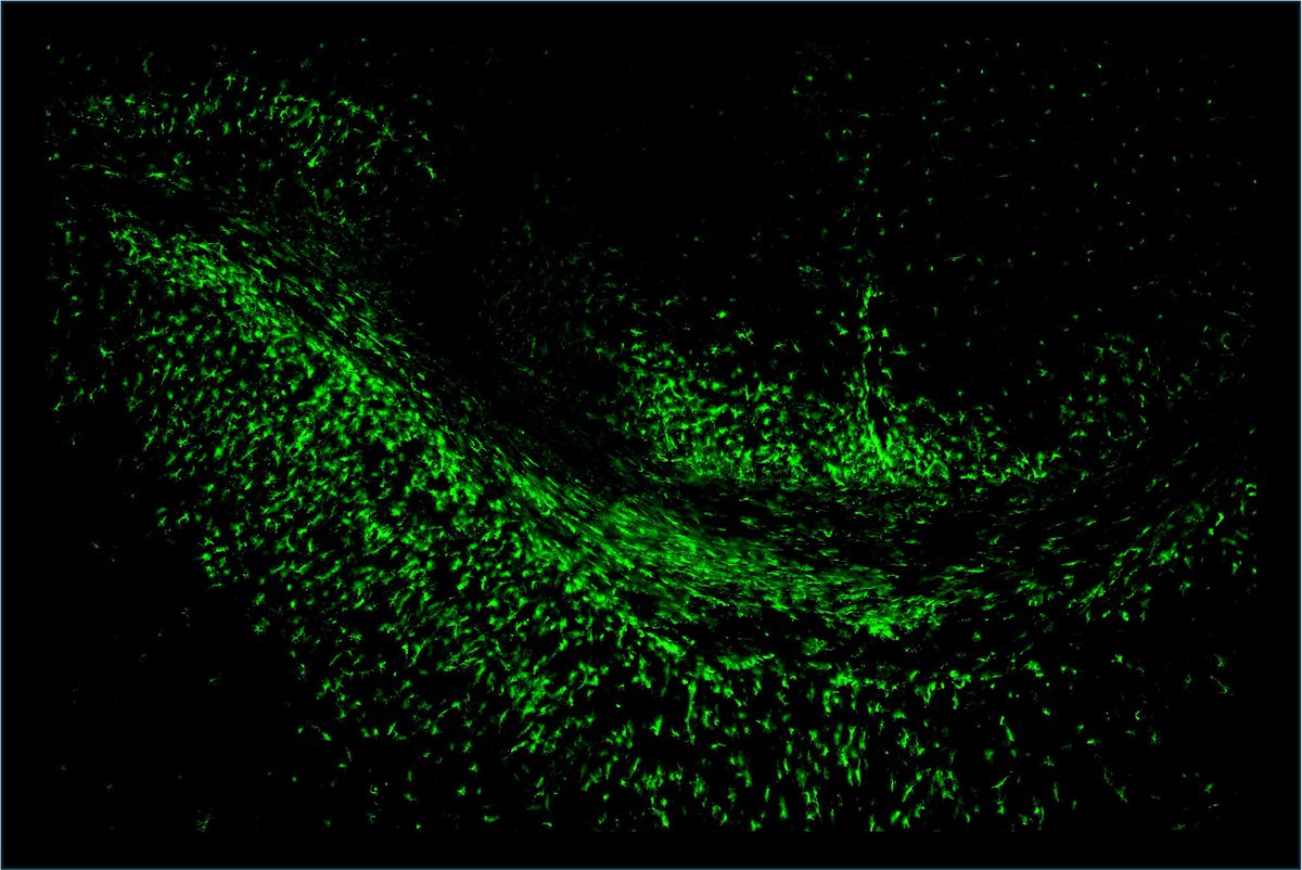 Microglia in action💪! An army of immune cells swarms the corpus callosum in a Sprague-Dawley rat brain, revealing the CNS's inner defenses.

Congratulations to Meike Mulder from UCC for being featured as the first-ever ECRN Microscopy Image Spotlight!🎉