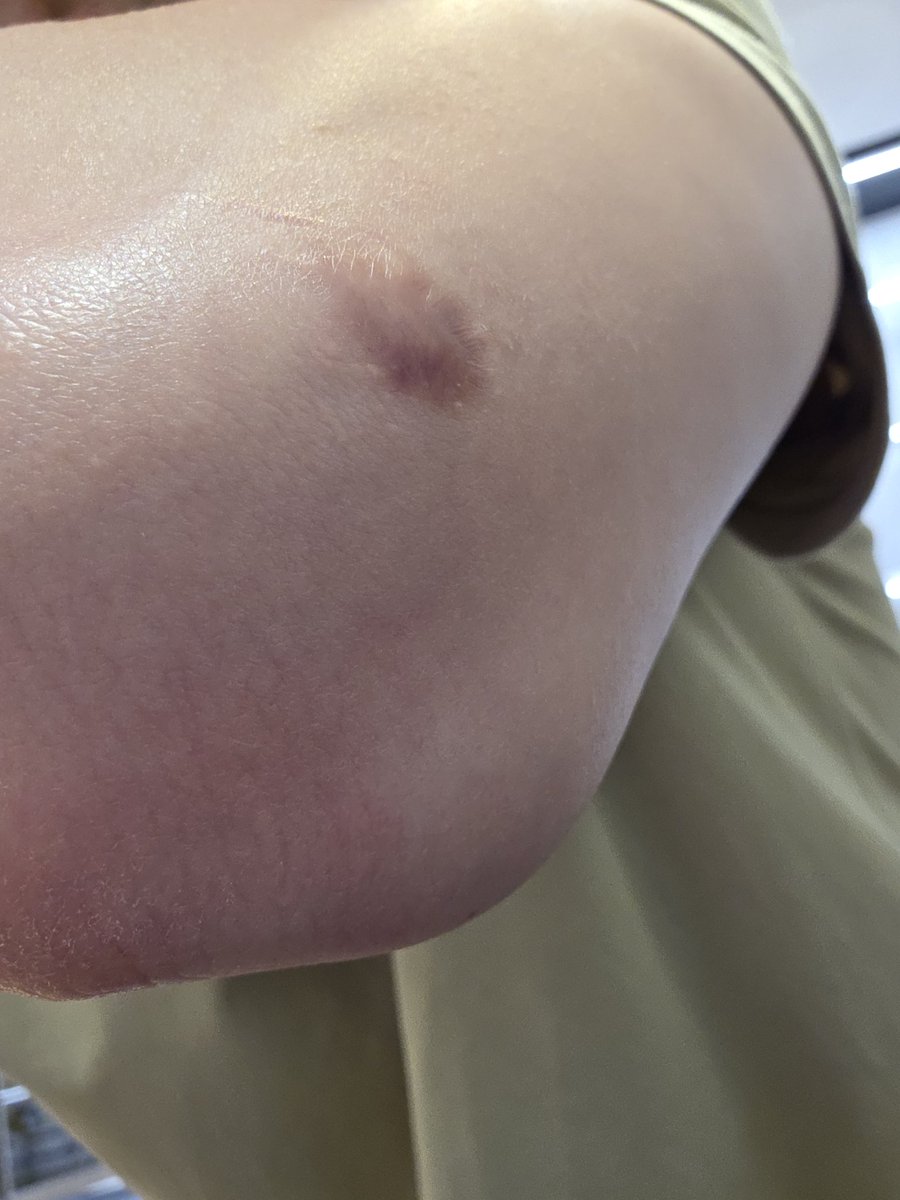 <a href="/Ya_KFC1150/">น้องญ่า</a> หมาตัดหน้าไหล แถ้ดๆๆร้องหยั่งหมา อย่าให้ขับเลย