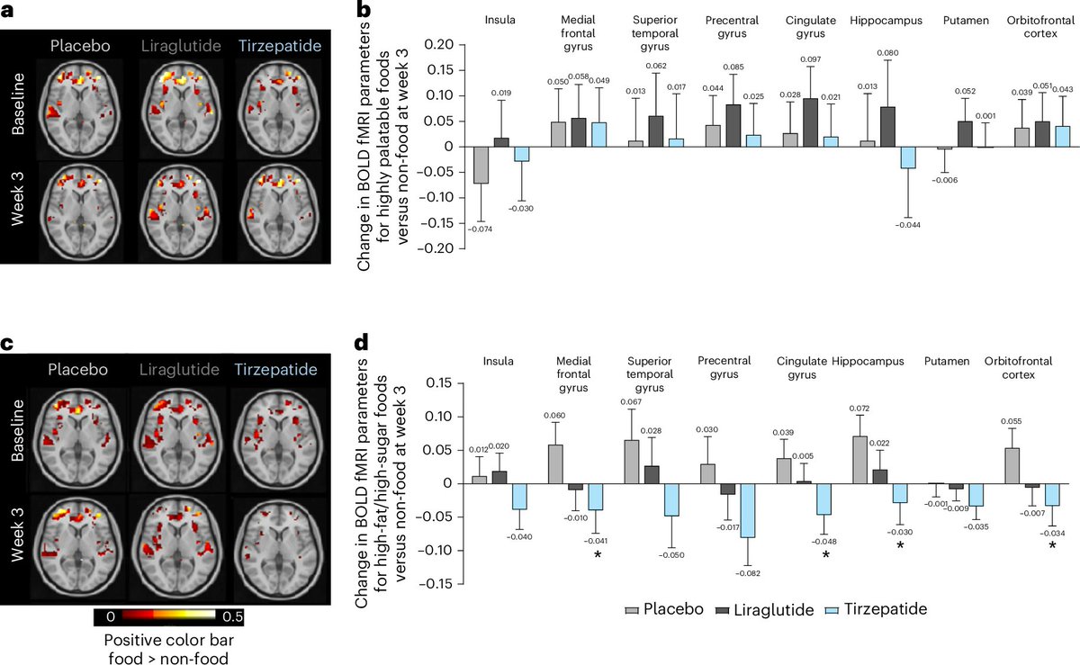 what does tirzepatide do to your brain Tirzepatide decreases activation of the brain to high-fat, high-sugar food  photos in the medial frontal and cingulate gyri, orbitofrontal cortex and  hippocampus. This brain effect may explain in part reduced food intake
