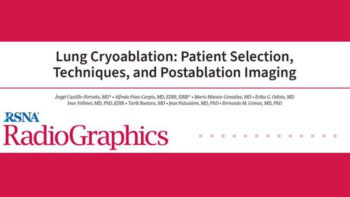 Alfredo PĂĄez-Carpio (@apaezcarpio) on Twitter photo 0/
Lung cryoablation (LCA) is a powerful yet underutilized tool in thoracic oncology. Our international team reviews patient selection, technique, complications, and imaging outcomes to master LCA in practice đ§”đ
<a href="/RadioGraphics/">RadioGraphics</a> <a href="/RadG_Editor/">RadioGraphics_Editor</a> <a href="/cookyscan1/">Cooky Menias</a> <a href="/teachplaygrub/">Lea Alhilali, MD</a> #RGphx 0/
Lung cryoablation (LCA) is a powerful yet underutilized tool in thoracic oncology. Our international team reviews patient selection, technique, complications, and imaging outcomes to master LCA in practice đ§”đ
<a href="/RadioGraphics/">RadioGraphics</a> <a href="/RadG_Editor/">RadioGraphics_Editor</a> <a href="/cookyscan1/">Cooky Menias</a> <a href="/teachplaygrub/">Lea Alhilali, MD</a> #RGphx