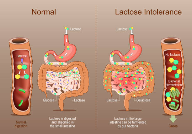 One of the most overlooked digestive problems today:

Lactose Intolerance.

It’s not just about milk…

It’s a warning sign of poor gut function.

Here’s what causes it, what it really means, and how to fix it naturally: