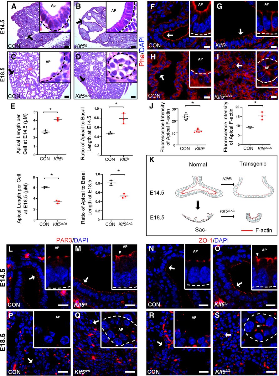 ATS Red Journal (@ajrcmb) on Twitter photo KLF5 Shapes Developing Respiratory Tubules by Inhibiting Actin Asymmetry in Epithelial Cells
<a href="/atscommunity/">American Thoracic Society (ATS)</a>
🔗atsjournals.org/doi/full/10.11… KLF5 Shapes Developing Respiratory Tubules by Inhibiting Actin Asymmetry in Epithelial Cells
<a href="/atscommunity/">American Thoracic Society (ATS)</a>
🔗atsjournals.org/doi/full/10.11…