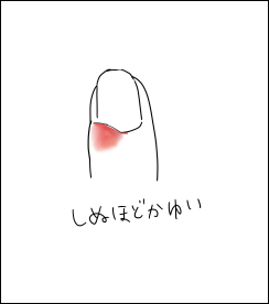 秒で蚊に選ばれるニンゲンだから全身で刺されていない部位はもう無いと思って生きていたけど、本日その甘い考えを改めました。 