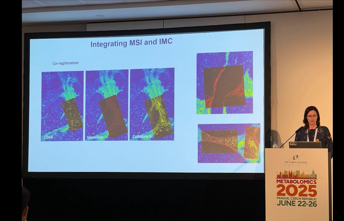Zoe Hall (@zoehall_icl) on Twitter photo Enjoying #Metabolomics2025 in Prague where I just presented some of our work on #massspec imaging of #liver fibrosis! <a href="/Gruevska_A/">Aleksandra Gruevska</a> Enjoying #Metabolomics2025 in Prague where I just presented some of our work on #massspec imaging of #liver fibrosis! <a href="/Gruevska_A/">Aleksandra Gruevska</a>