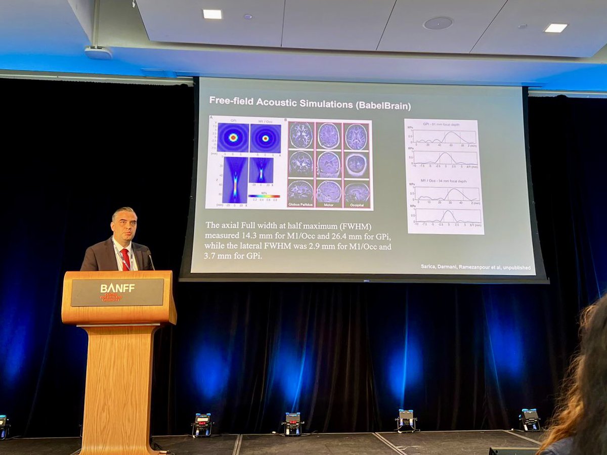 CANSARICA2's tweet image. Thrilled to join the 24th Annual International Symposium for Therapeutic Ultrasound #ISTU2025 in stunning Banff! We shared our latest work on ultrasound in movement disorder patients with 4 oral presentations from the Chen Lab. Great to reconnect with colleagues worldwide—huge…